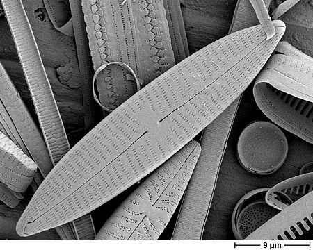 REM-Aufnahme einer Kieselalgenmischprobe mit Navicula tripunctata - Foto: Gabriele Hofmann